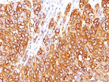 MART-1 / Melan-A Antibody