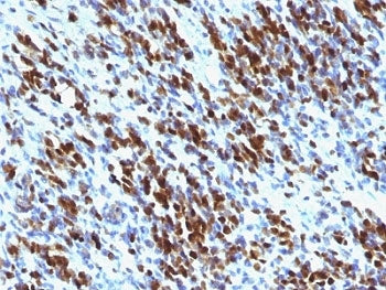 Myogenin Antibody Cocktail