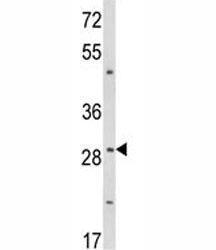 TTP Antibody (Tristetraprolin)
