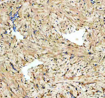 IHC staining of FFPE zebrafish heart tissue with Psmc3 antibody, HRP-labeled secondary and DAB subst