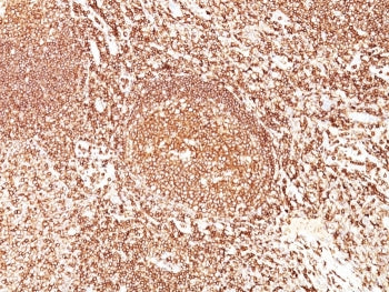 CD45 Antibody (Leukocyte marker)