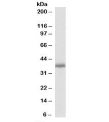 Western blot testing of mouse lung lysate with PDLIM2 antibody at 0.3ug/ml. Predicted/observed molec