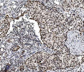 PRDM14 Antibody