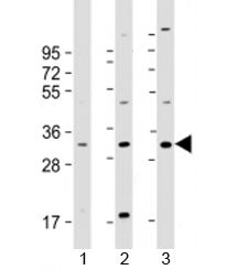 Western blot testing of human 1) U-2OS, 2) U-251 MG and 3) A431 cell lysate with FAM125A antibody at