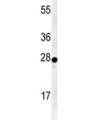 AANAT Antibody