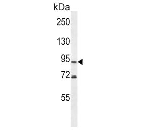 Western blot testing of human MDA-MB-453 cell lysate with Phospholipase D2 antibody. Predicted molec