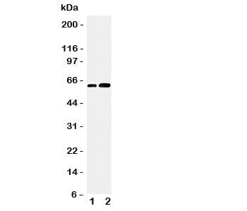 Western blot testing of CDC6 antibody and Lane 1: Jurkat; 2: MCF-7 cell lysate. Predicted/observed m