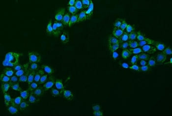 Immunofluorescent staining of FFPE human A431 cells with ASIC2 antibody (green) and DAPI nuclear sta