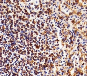 NFKB1 Antibody