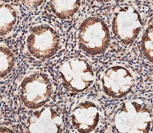 IHC testing of FFPE human colon tissue with Prohibitin 2 antibody. HIER: steam section in pH9 EDTA b