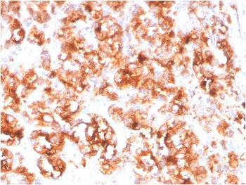 Folate Hydrolase 1 Antibody / FOLH1 / PSMA