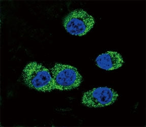 Confocal immunofluorescent analysis of RAGE antibody with MDA-MB231 cells followed by Alexa Fluor 48