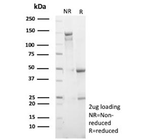 SDS-PAGE analysis of purified, BSA-free recombinant MKI67 antibody (clone rMKI67/9616) as confirmati