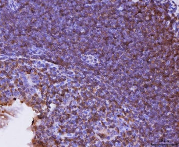 Cxcr3 Antibody