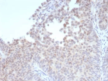 IHC staining of FFPE human bladder tissue with recombinant Estrogen Receptor beta 1 antibody (clone 