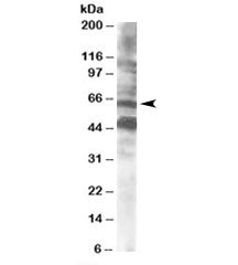 Western blot testing of human brain lysate with CPEB antibody at 0.5ug/ml. Both the expected ~65kDa 