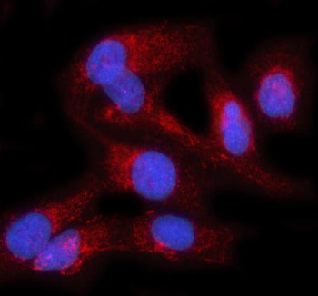 Immunofluorescent staining of PRAG1 using anti-PRAG1 antibody (red). PRAG1 was detected in an immuno