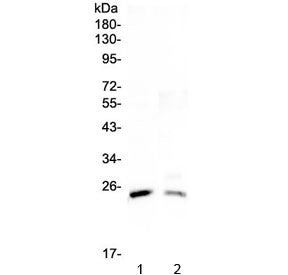 Western blot testing of 1) rat testis and 2) mouse testis lysate with StAR antibody at 0.5ug/ml. Exp