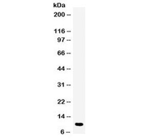 DBI Antibody / Diazepam Binding Inhibitor