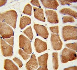 IHC testing of FFPE human skeletal muscle tissue with Enoyl-CoA delta isomerase 2 antibody. HIER: st