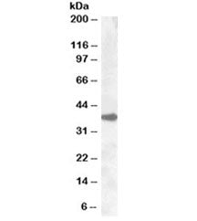 Western blot testing of A431 lysate with ERCC1 antibody at 0.3ug/ml. Predicted molecular weight ~36k