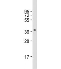 Western blot testing of human Raji cell lysate with RASSF2 antibody at 1:1000. Predicted molecular w