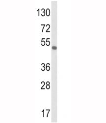 VEGF-C Antibody