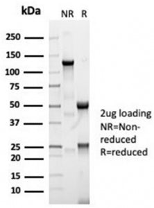 SDS-PAGE analysis of purified, BSA-free ACE antibody (clone ACE/7004R) as confirmation of integrity 