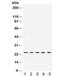 Western blot testing of 1) rat spleen, 2) rat testis, 3) mouse brain, 4) moust thymus, 5) human HeLa