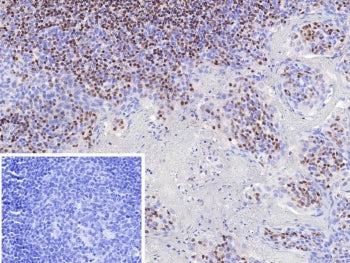 IHC staining of FFPE human tonsil tissue with Paired box 3 antibody (clone PAX3/8424). Inset: PBS us