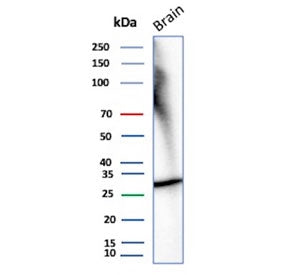 Western blot testing of human brain tissue lysate with recombinant CALB2 antibody. Predicted molecul