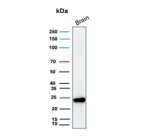 Western blot testing of human brain tissue lysate with PGP9.5 antibody (clone UCHL1/8153). Predicted