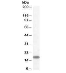Western blot testing of human testis lysate with STMN1 antibody at 1ug/ml. Predicted molecular weigh