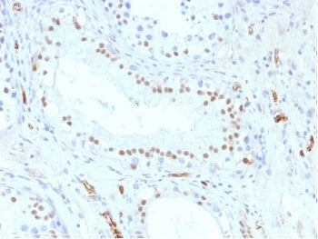 IHC testing of formalin-fixed, paraffin-embedded human testis stained with WT1 antibody (clone WT1/8