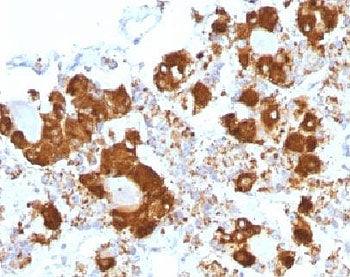 IHC testing of FFPE human pituitary gland with ACTH antibody (clone CLIP/1407). Required HIER: steam