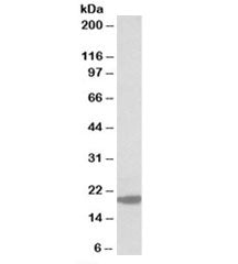 MCT-1 Antibody / MCTS1