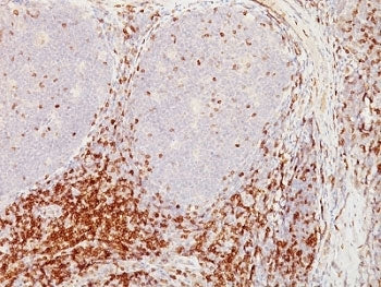 IHC analysis of formalin-fixed, paraffin-embedded human tonsil stained with CD5 antibody (clone CD5/