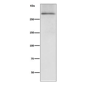 Western blot testing of human fetal heart lysate with Dystrophin antibody. Predicted molecular weigh