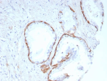 Cytokeratin 14 Antibody / CK14 / KRT14