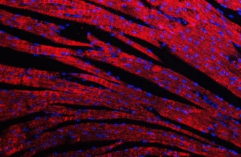 Desmin Antibody
