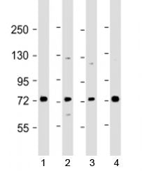 Western blot testing of human 1) Raji, 2) A549, 3) HL-60 and 4) K562 cell lysate with SKI antibody a