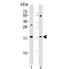 Western blot testing of human 1) HL60 and 2) Jurkat cell lysate with KiSS-1 antibody. Predicted mole