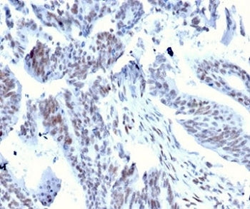 IHC staining of FFPE human colon tissue with Serum Response Factor antibody (clone PCRP-SF7-1F1) at 