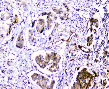 CDA Antibody / Cytidine deaminase