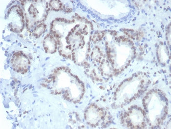 IHC staining of FFPE human prostate tissue with Fli1 antibody (clone FLI1/7508). HIER: boil tissue s