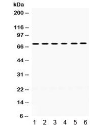LIM Kinase 2 Antibody / LIMK2