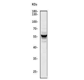 TGFBR1 Antibody / TGF beta Receptor I