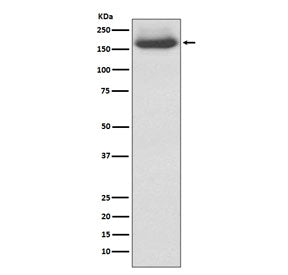 Western blot testing of human 293T cell lysate with NF-M antibody. Predicted molecular weight: ~102 