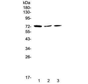 Western blot testing of human 1) HeLa, 2) MCF7 and 3) A375 cell lysate with TORC2 antibody at 0.5ug/