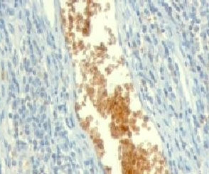 AMPD3 Antibody